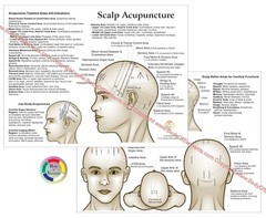 Scalp Acupuncture Points Chart 8.5″ X 11″ Head Microsystem