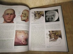 Fundamentals of Pain Medicine: How to Diagnose and Treat Your Patients 2014