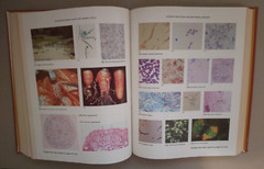 Microbiology–Wistreich and Lechtman–hardback–1984–916 pages plus appendices